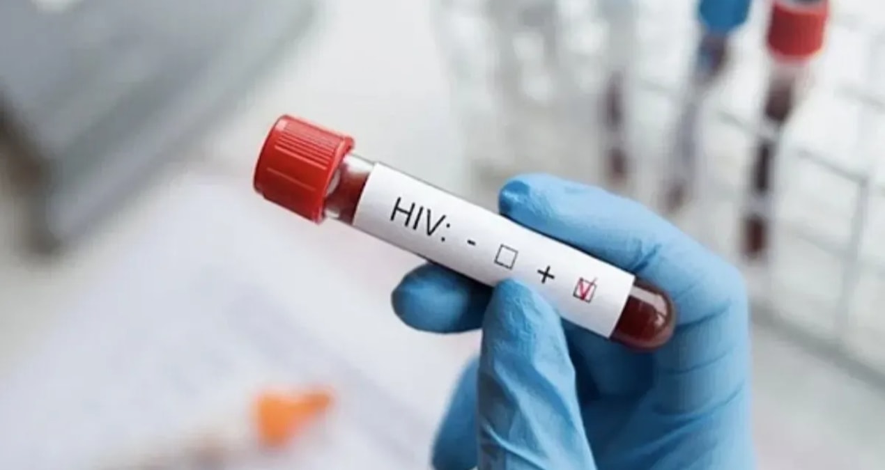 Kızılay’dan ‘AIDS’li kan’ iddiasıyla ilgili açıklama