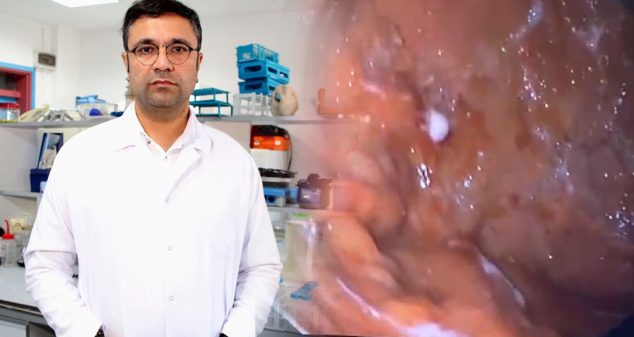 Ölü vücutlar incelendi: İçimiz süratle plastik doluyor!