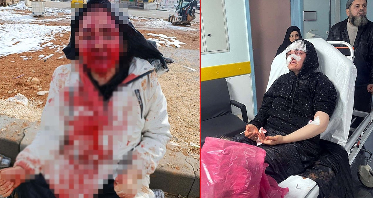 Boşanmak isteyen eşini kaldırım taşıyla bu hale getirdig