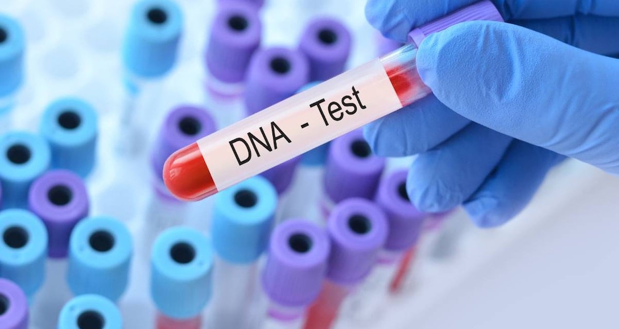 Karı koca eğlence olsun diye DNA testi yaptırdı: Korkunç aile sırrı ortaya çıktı
