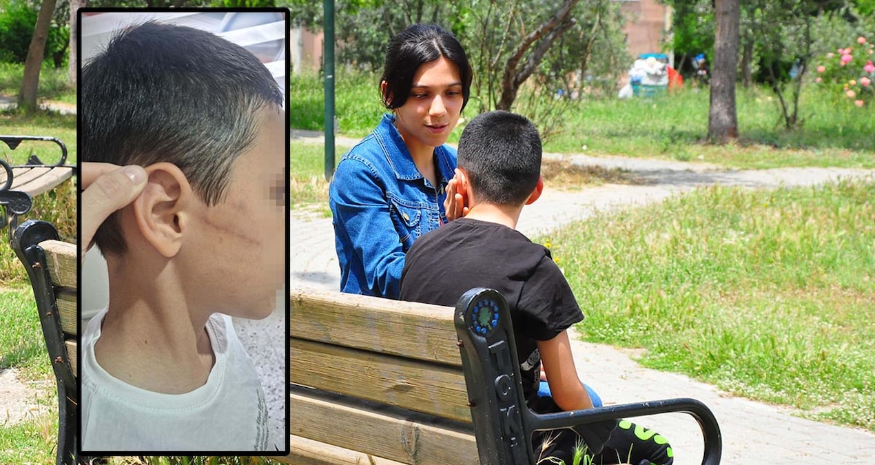 Vicdansız baba 12 yaşındaki oğlunu feci şekilde darp etti