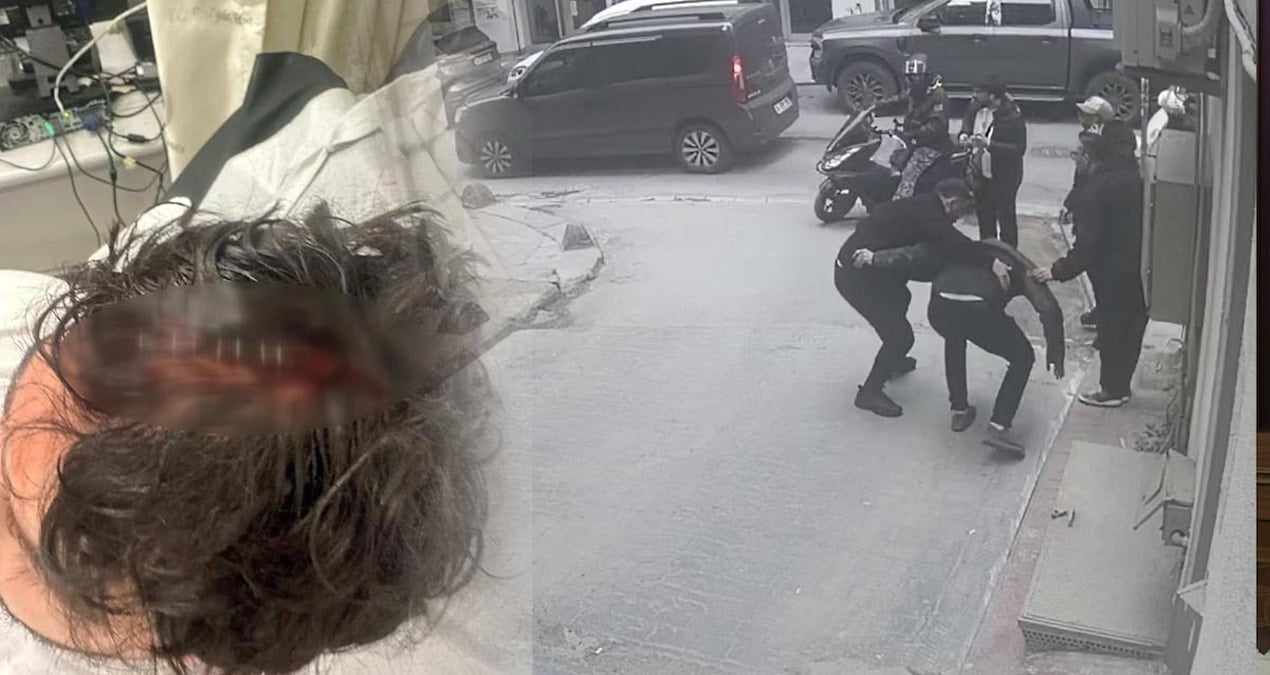 Yolda yürürken ölümden döndü: Kafasına 7 dikiş atıldı